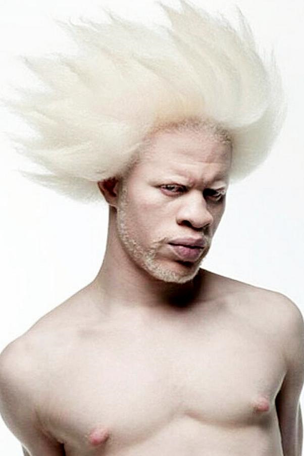 Big albino dick