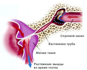 Могут ли сопли попасть в евстахиеву трубу