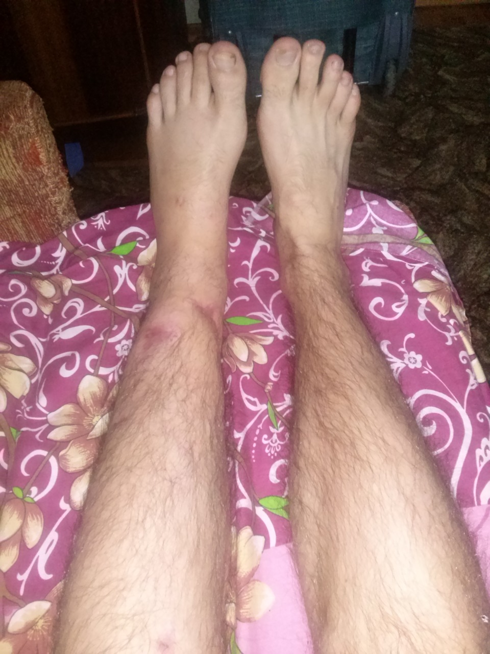 Фото в бортжурнале Honda Civic 4D (8G)