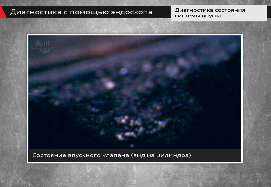 Применение эндоскопа в диагностике — VAG-DOCTOR на DRIVE2