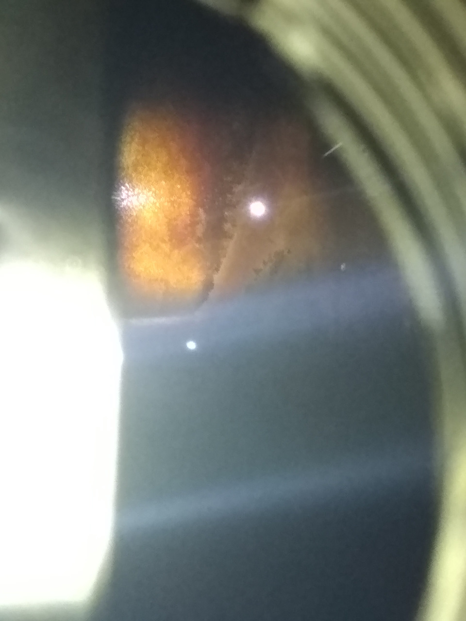 Как победить "детонацию/дребезг цепи" и прочие лишние звуки двигателя ...