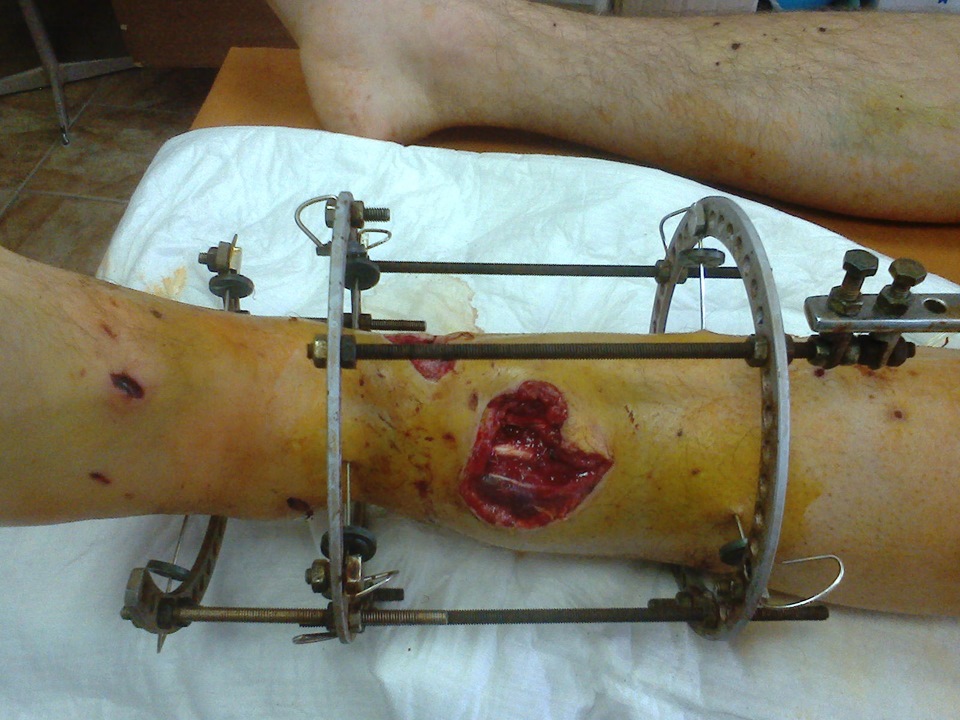 Фото в бортжурнале Honda Civic 4D (8G)