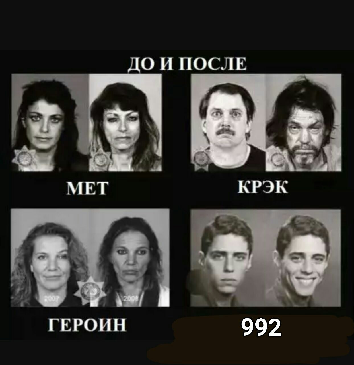 992 головного мозга :D 