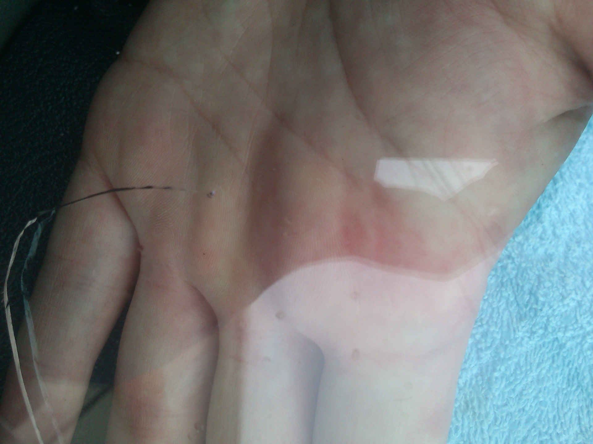 Остановка трещины на лобовом — пустая трата денег — Renault Symbol, 1,4 ...