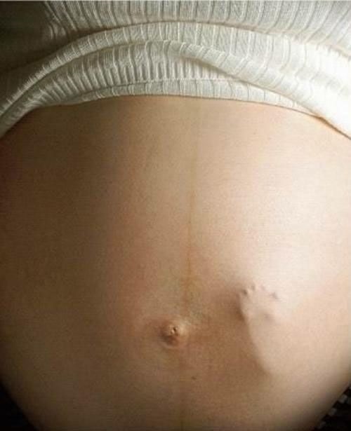 Невероятные факты про беременность. — Сообщество «Мальчики и Девочки» на  DRIVE2