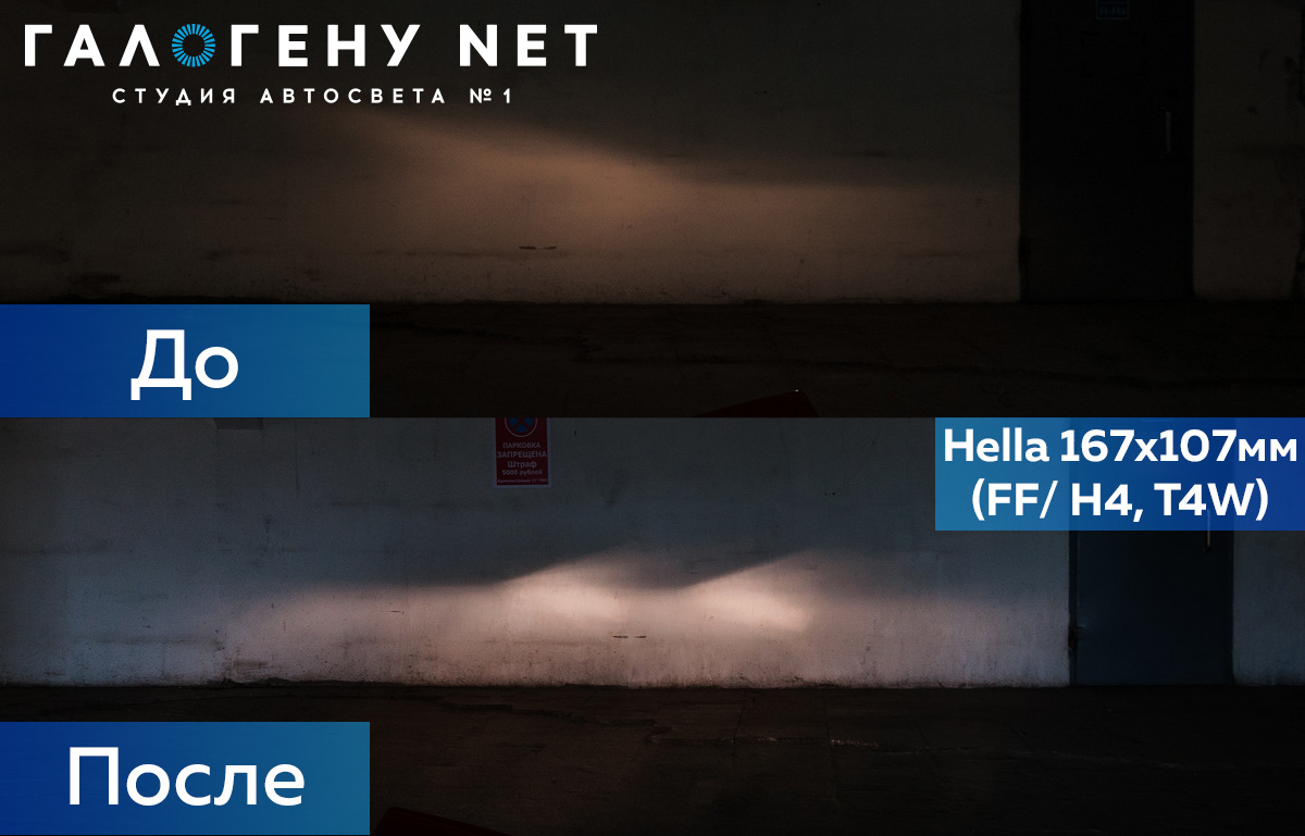 морщины до после азиатки. нитевой лифтинг фото до и после. липолитик в веки верхние фото. окончания в английском языке произношение. примеры постов до после.