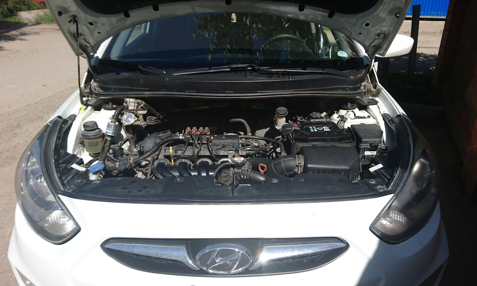 Немного почистил под капотом👌 — Hyundai Solaris, 1,6 л, 2013 года ...