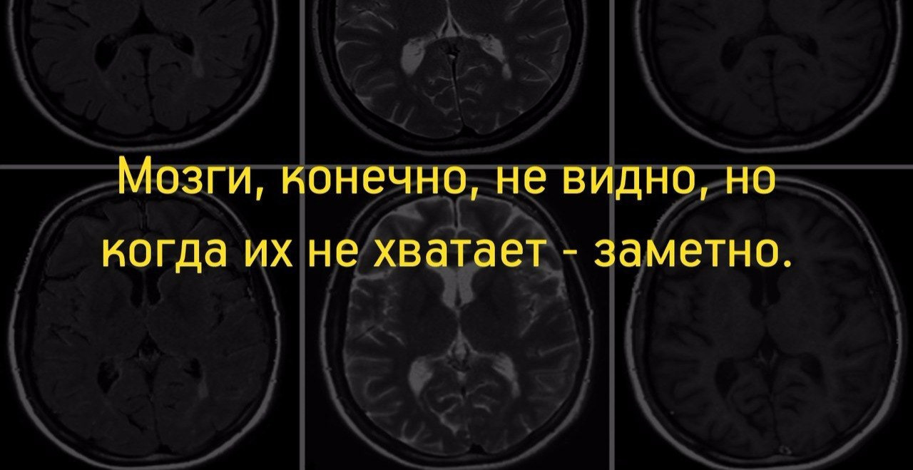 Отсутствие мозгов. Не хватает мозгов. Когда нет мозга.