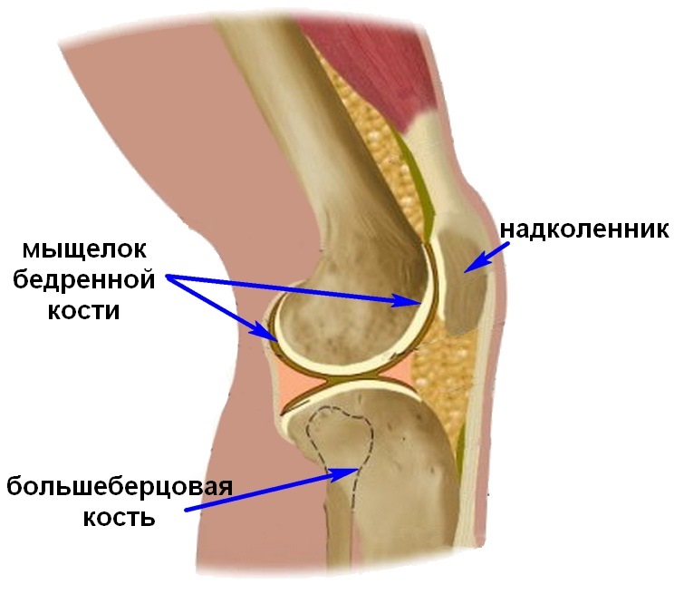 Коленно бедренный сустав. Болит мыщелок бедренной кости. Кость мыщелка большеберцовой кости. Колено сбоку на косточке болит. Мыщелок коленного сустава большеберцовой кости.