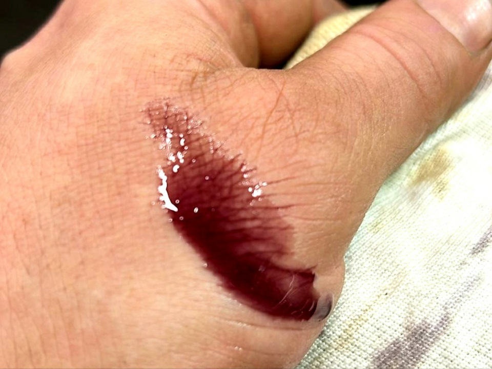 хоть Aisin A44DE отличается живучестью, и масло менялось совсем недавно, но я очень люблю побуксовать, а значит увидел тёмное масло — меняй! — Suzuki Grand Vitara (2G)