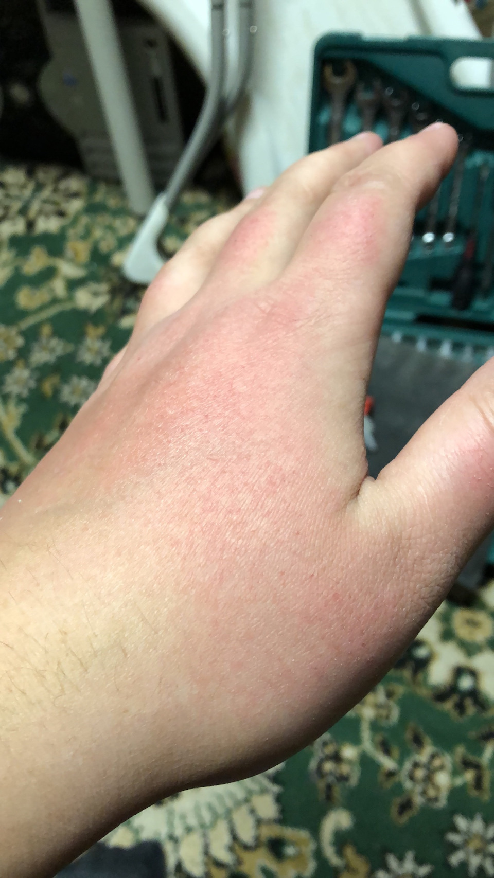 Ах да, если вы всё сделали правильно, ваши руки должны быть примерно такими)))))шучу кончено же, но я не хотел пачкать зимние перчатки маслом, которое впиталось в инструмент и готово с него впитаться в руки, которые будет сложно отмыть. Вот я моя водой(руки) и таская потом голыми, но в то же время чистыми руками и заветрил их в хлам, потом неделю мучился — BMW 2 series Active Tourer (F45)