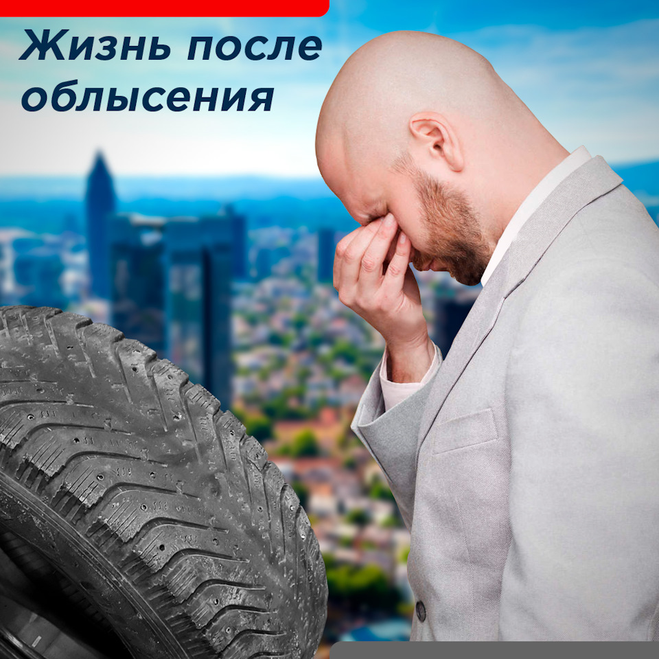 Жизнь после облысения — Колесо.ру на DRIVE2