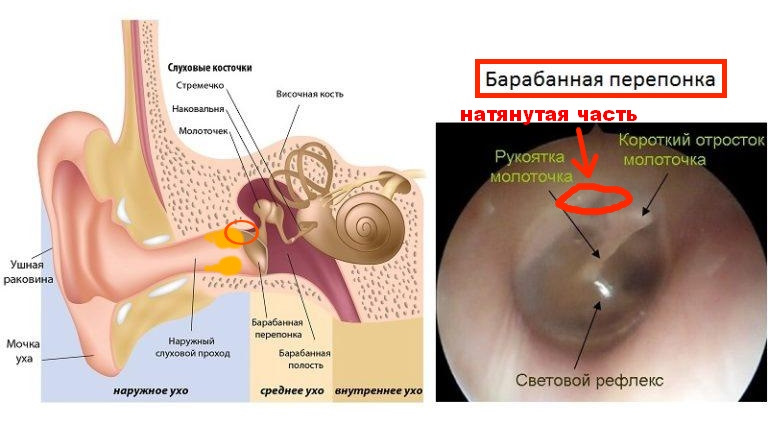 Воспаленное ухо внутри фото