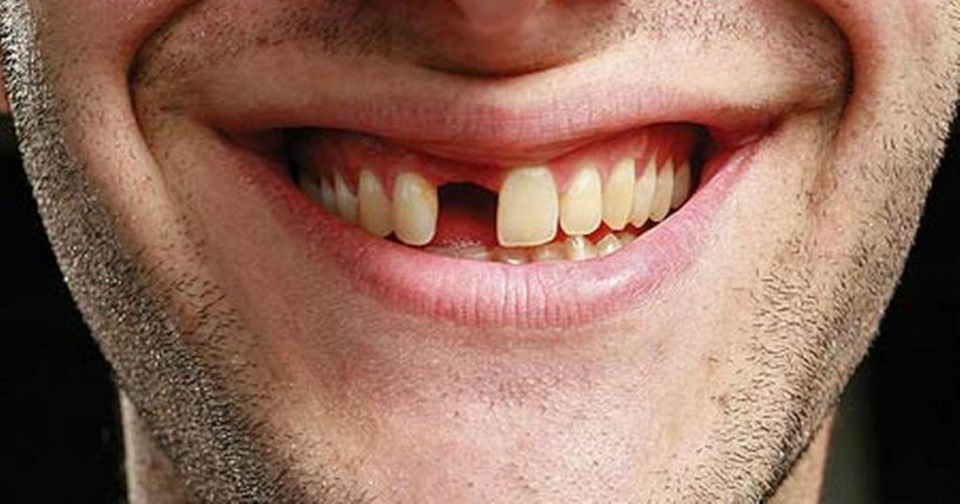 Pin by Dr. Garth on Dr. Riopelle DDS First tooth, Dds, Teeth