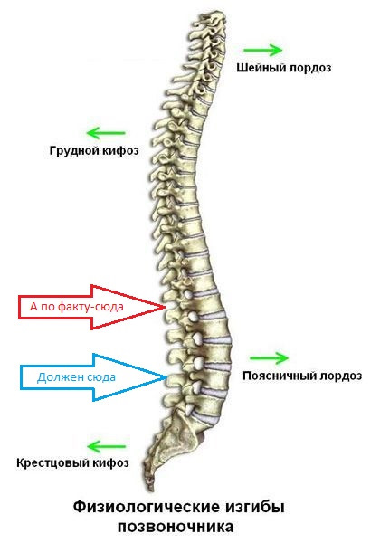 Лордоз картинки позвоночника
