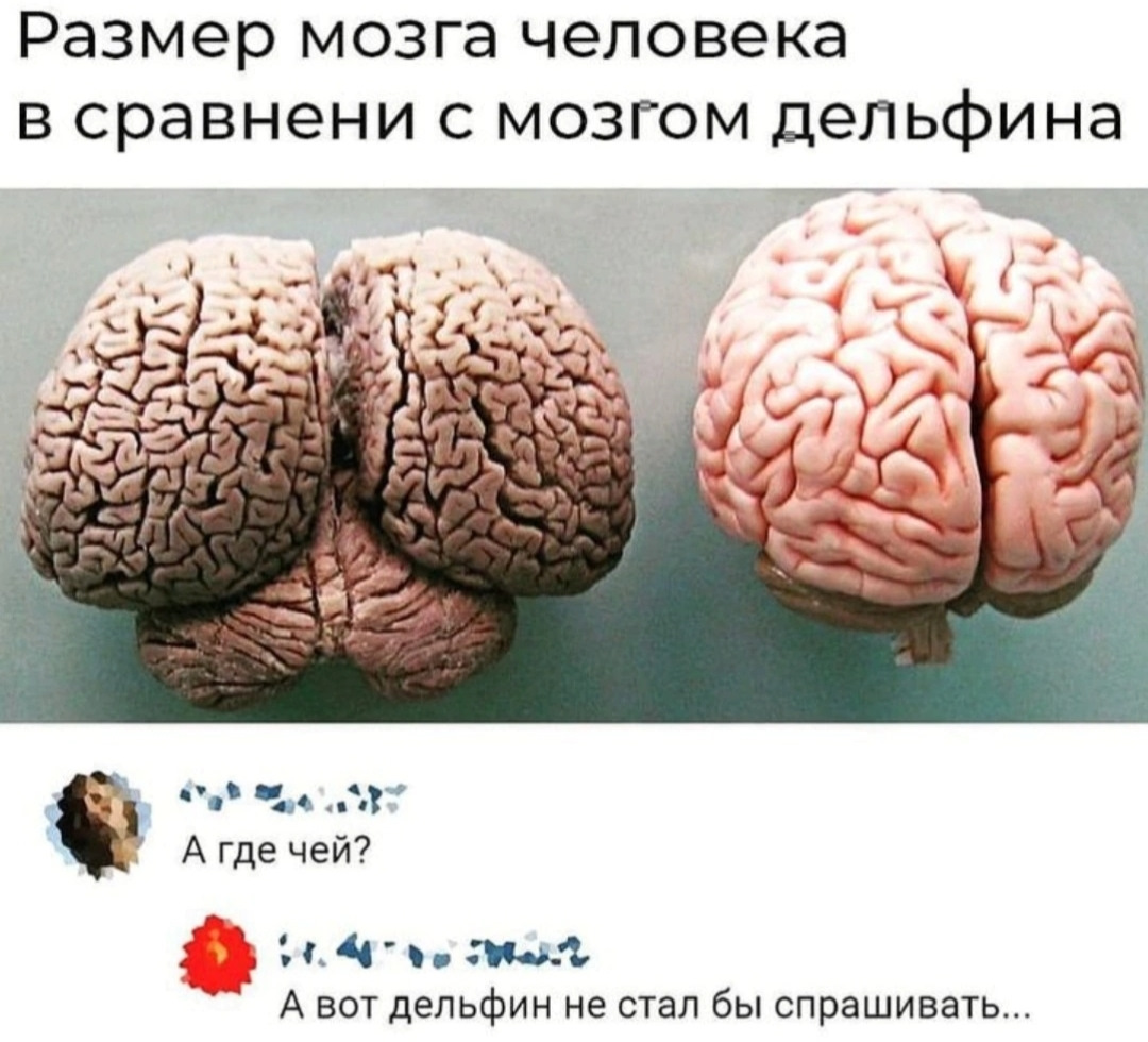 Как выглядит человек без мозгов