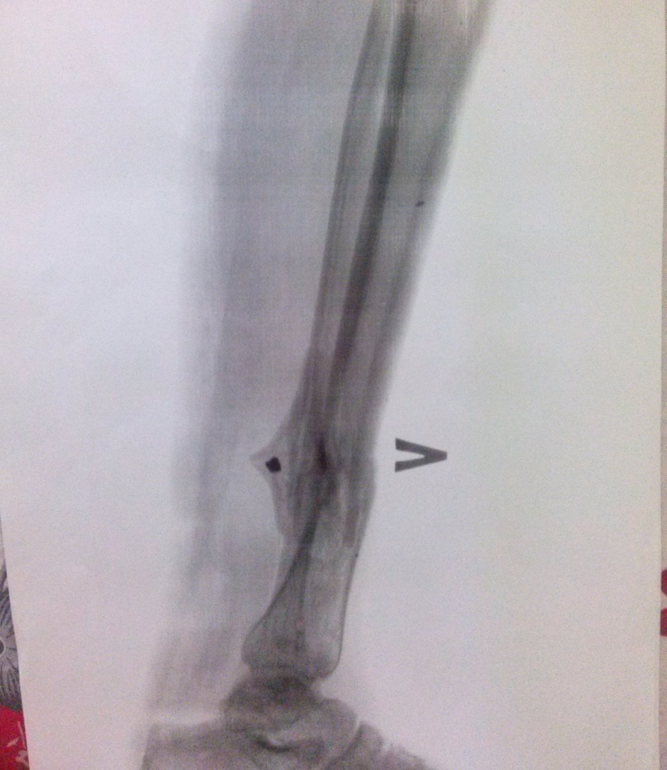 Фото в бортжурнале Honda Civic 4D (8G)