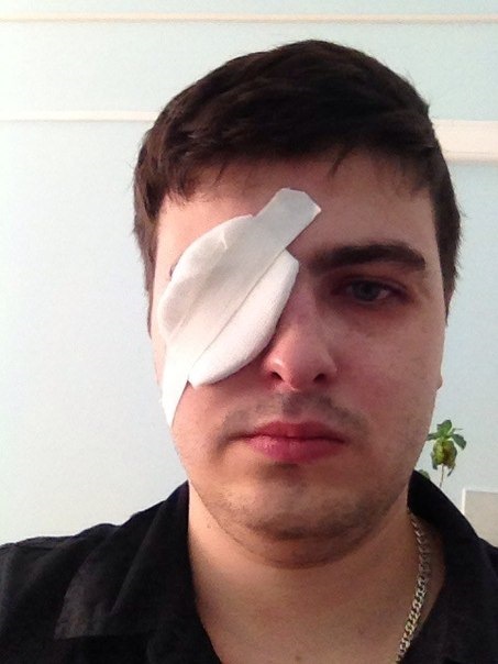 Травма, или как обломалась поездка в Беларусь) — DRIVE2