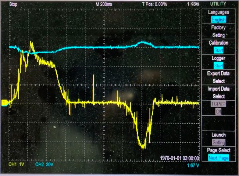 График разгона и торможения рекуперацией. — Mercedes-Benz A-Class (W168)