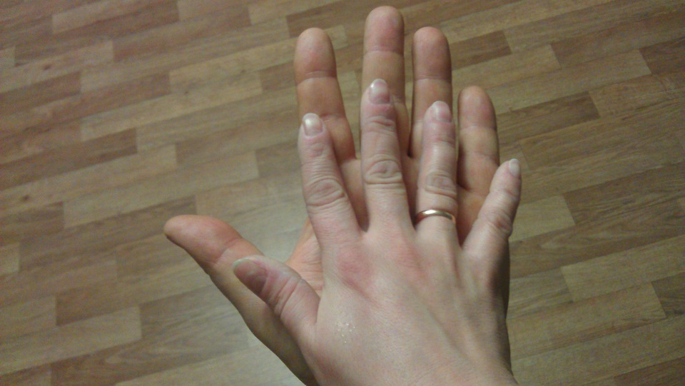 Не большое обслуживание и ремонт. — Suzuki SX4 (1G), 1,5 л, 2007 года ...