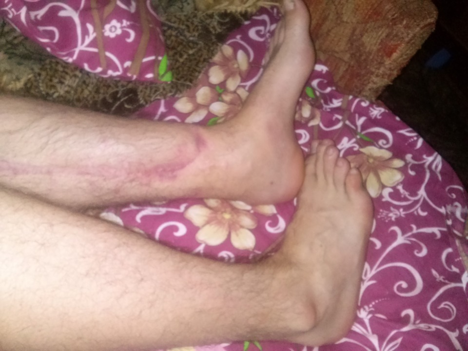 нога такая — Honda Civic 4D (8G)