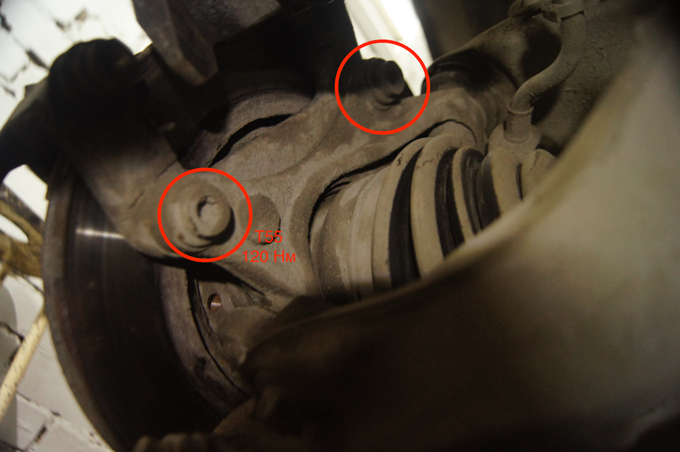 Что то щелкает при движении. Щелчки при повороте руля. Подвывих плечевого сустава. Подвывих плечевой кости. Растяжка мышц предплечья.