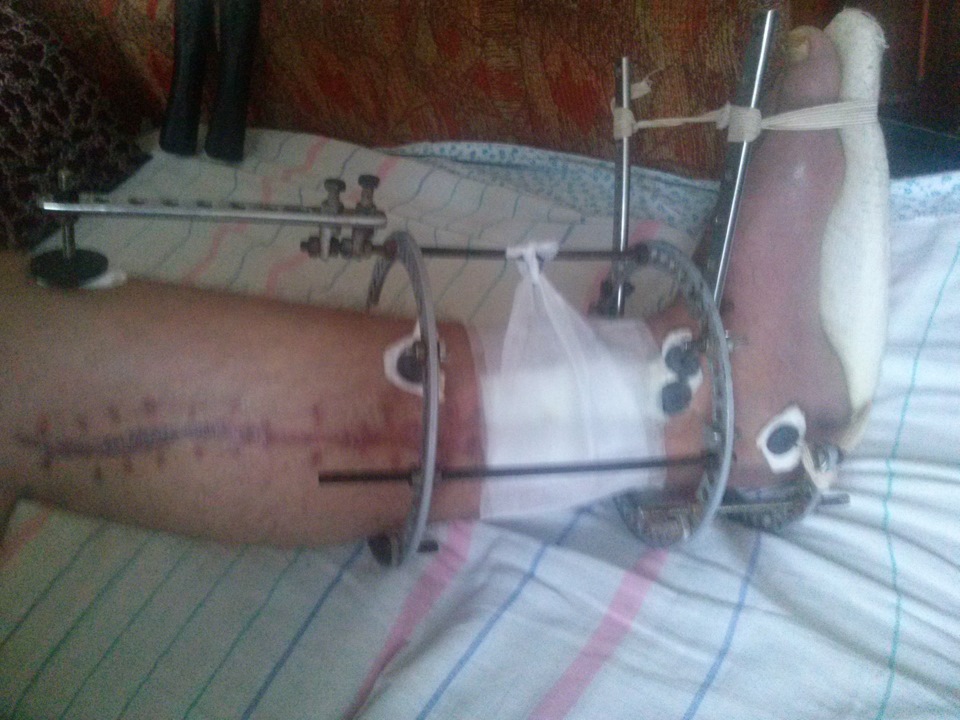 Фото в бортжурнале Honda Civic 4D (8G)