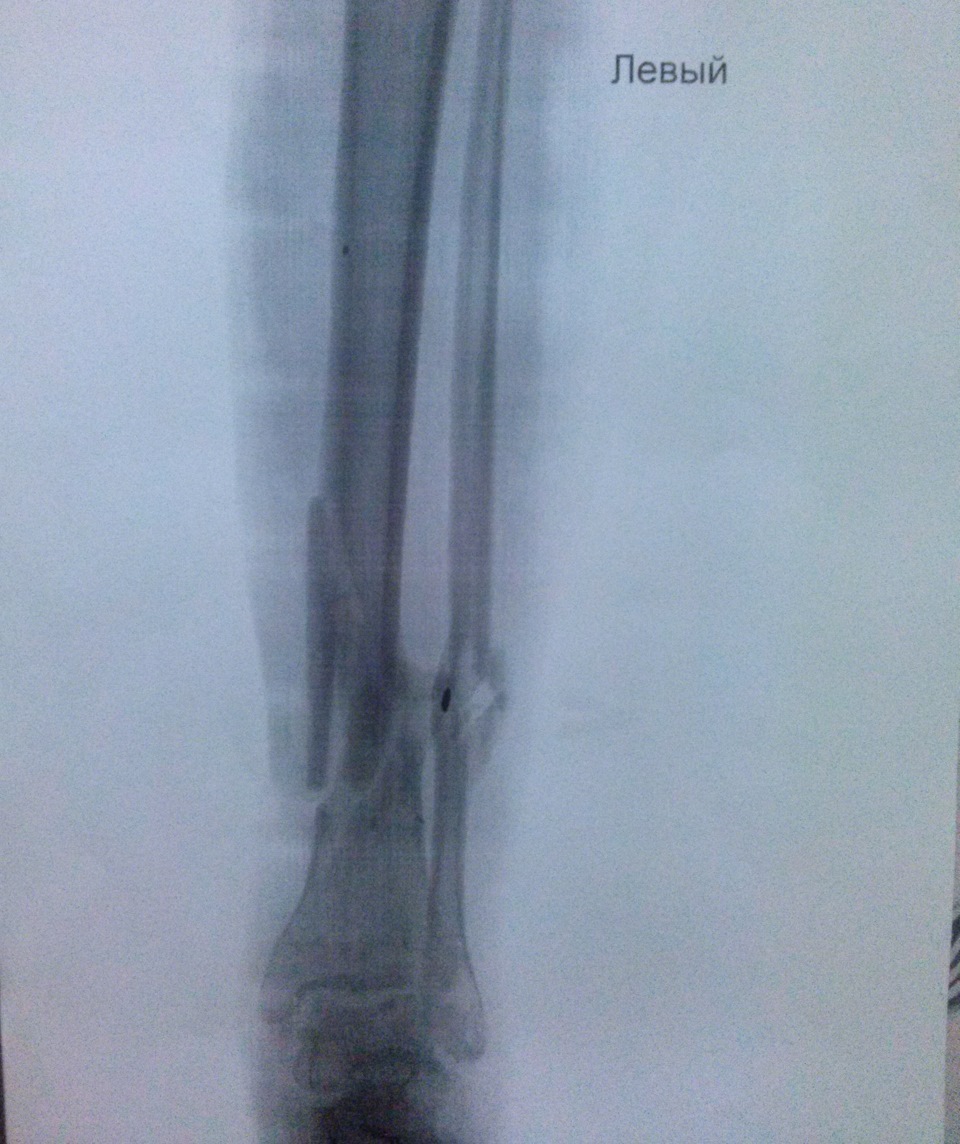 Фото в бортжурнале Honda Civic 4D (8G)