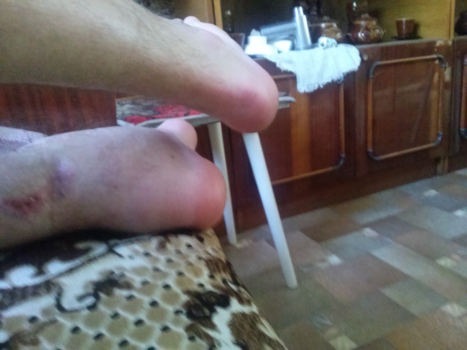 Фото в бортжурнале Honda Civic 4D (8G)