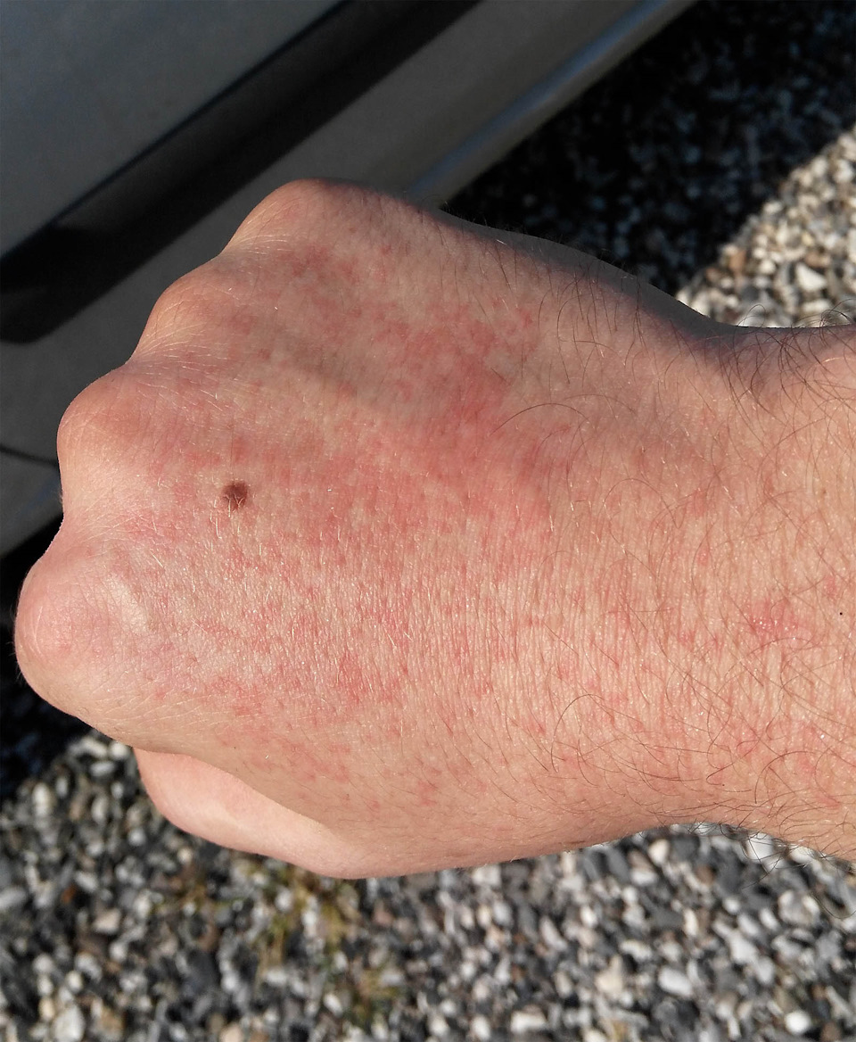 Фото в бортжурнале Nissan Sentra (B17)