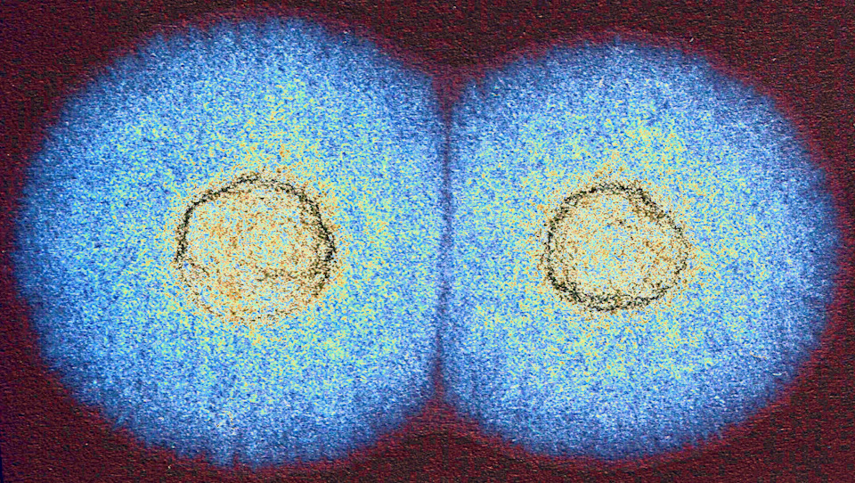 Капельный метод проверки масла. Капельный тест. — Suzuki Liana, 1,6 л ...