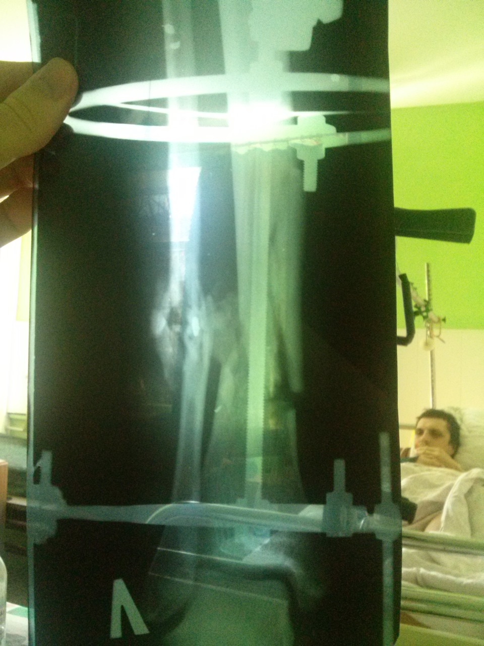 Фото в бортжурнале Honda Civic 4D (8G)