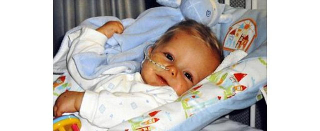 Ребенку 8 месяцев заболел. Реальные фото детей с менингитом. Фото ребенок Англии болен. Опухоль мозга у 2 месячного ребенка.
