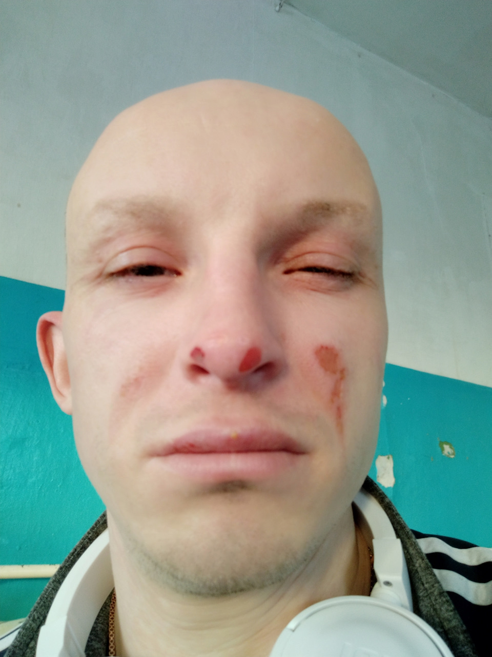 В хирургии — DRIVE2