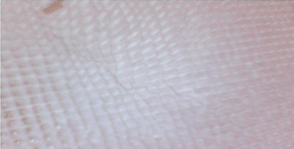 Как самому удалить катализатор на хендай солярис