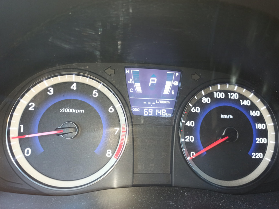 Мойка под капотом — Hyundai Solaris, 1,6 л, 2014 года | мойка | DRIVE2