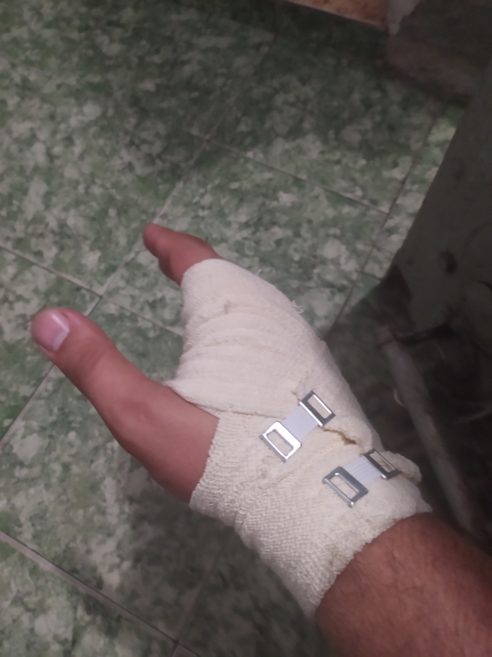 Замена помпы и сифона — Lada Калина седан, 1,5 л, 2009 года | визит на ...