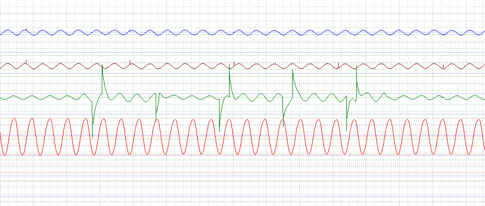 Диагностика датчиков ABS мотор тестером — DRIVE2